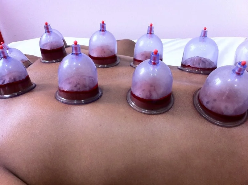 Package A - Wet Cupping